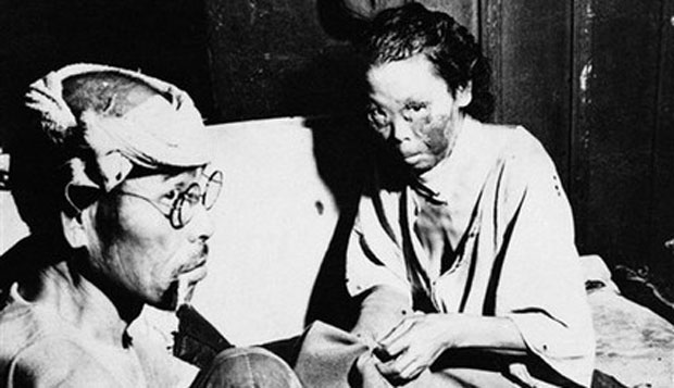 Hibakushas, sobreviventes de Hiroshima e Nagasaki que, ao longo dos anos, sofreram profunda discriminação pelos ferimentos evidentes.